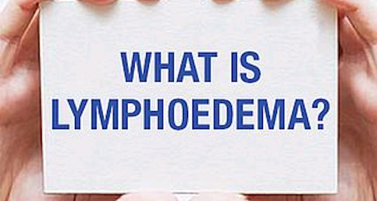 What is Lymphoedema?