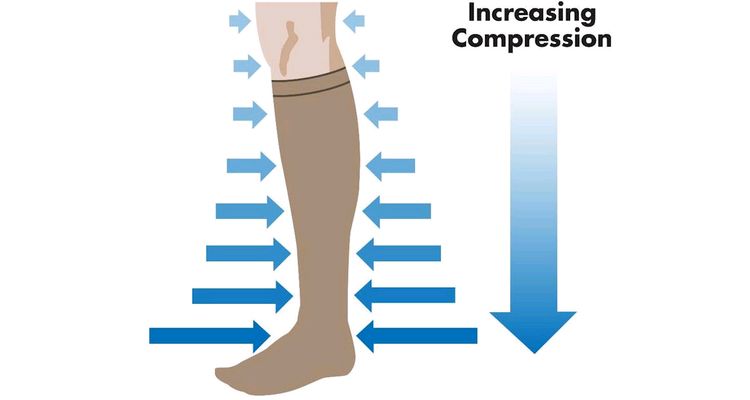 Do Compression Socks Work?