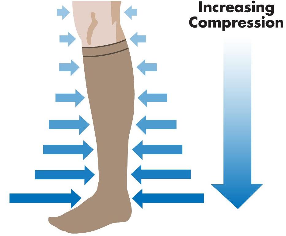 Ant grip Inaccurate What is Graduated Compression | Do Compression Socks Work